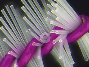 Độ sâu trường ảnh mở rộng