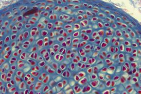 Thấy nhiều hơn với máy ảnh 5.0 CMOS megapixel