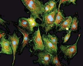 Hệ quang học huỳnh quang tự động