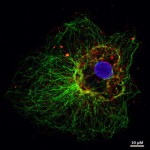 Làm thế nào để chuẩn bị mẫu cho Kính hiển vi miễn dịch huỳnh quang 