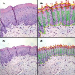 Dịch vụ phân tích bề dày lớp vật liệu 